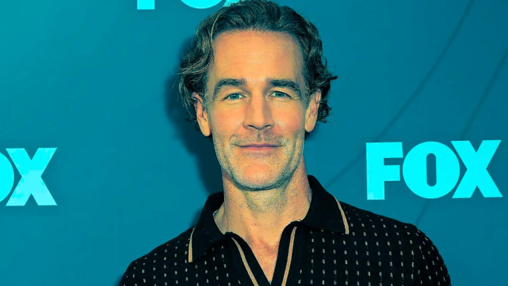 James Van Der Beek's Pink Eye Distress